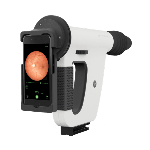 FOP NM-10 | Hand Held Fundus Camera