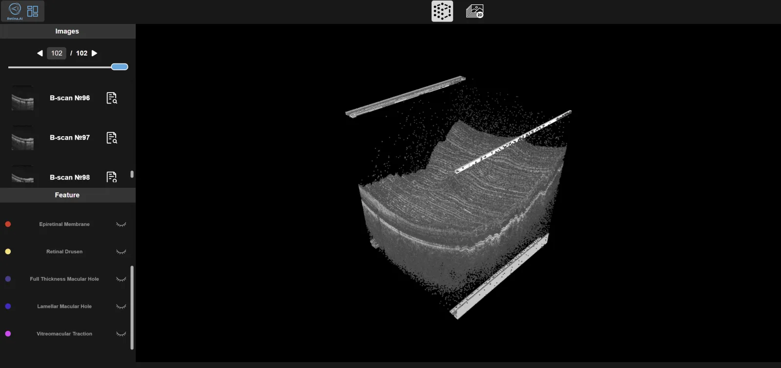 Retina.AI